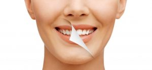 پیوند استخوان ایمپلنت دندان به چه صورت انجام می گیرد؟