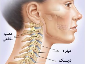 ورزش برای دیسک گردن + تمرین برای کاهش درد گردن ورزش برای دیسک گردن + تمرین برای کاهش درد گردن
