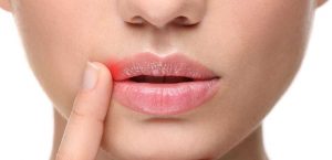 دلیل شیرین شدن دهان + دلایل و درمان احساس طعم شیرینی در دهان