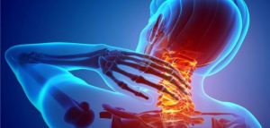 تقویت غضروف + روش های خانگی و خوراکی های مفید برای غضروف ها