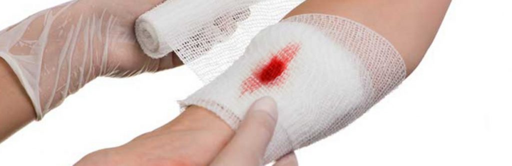 درمان خانگی عفونت زخم