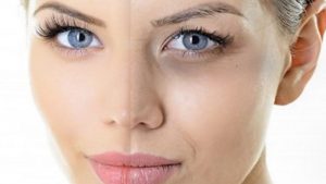 کربوکسی تراپی چیست | اثرات این روش برای جوان سازی پوست و رفع سیاهی دور چشم کربوکسی تراپی چیست | اثرات این روش برای جوان سازی پوست و رفع سیاهی دور چشم