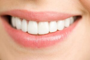 تفاوت لمینت کامپوزیت و سرامیک چیست و کدام بهتر است؟
