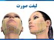 عوارض لیفت صورت با نخ و مزایایی که این روش زیبایی دارد عوارض لیفت صورت با نخ و مزایایی که این روش زیبایی دارد