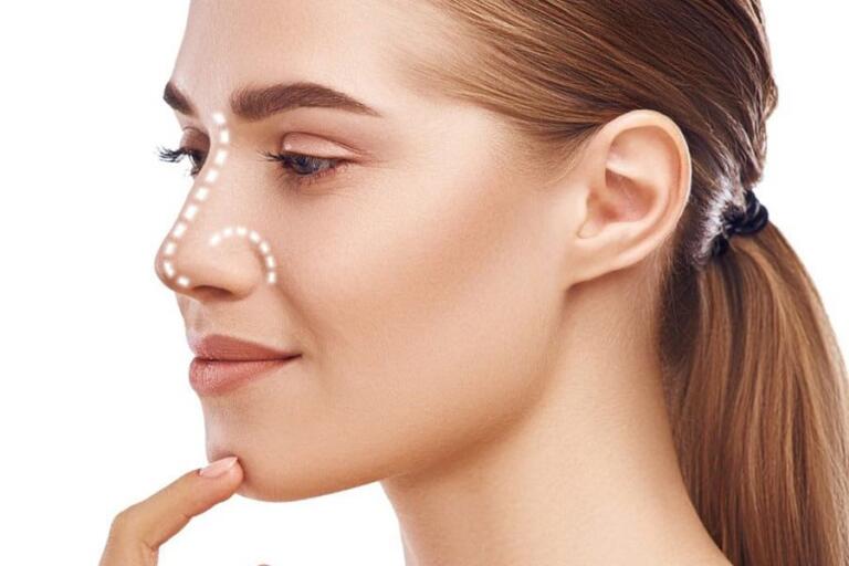 هزینه فیلر بینی چقدر است؟ هزینه فیلر بینی چقدر است؟