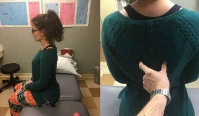 ورزش های مناسب برای افتادگی شانه