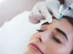 عوامل موثر برای افزایش ماندگاری بوتاکس