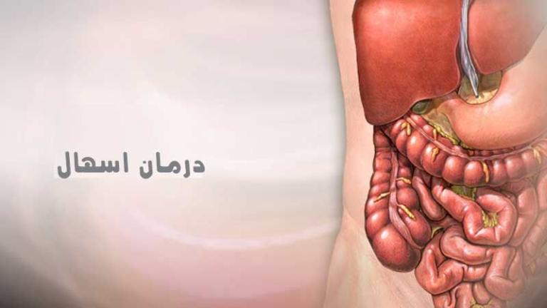 اسهال چیست؟ روشهای درمان و پیشگیری از این عارضه اسهال چیست؟ روشهای درمان و پیشگیری از این عارضه