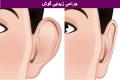 جراحی گوش برجسته یا اتوپلاستی و روش های انجام این عمل