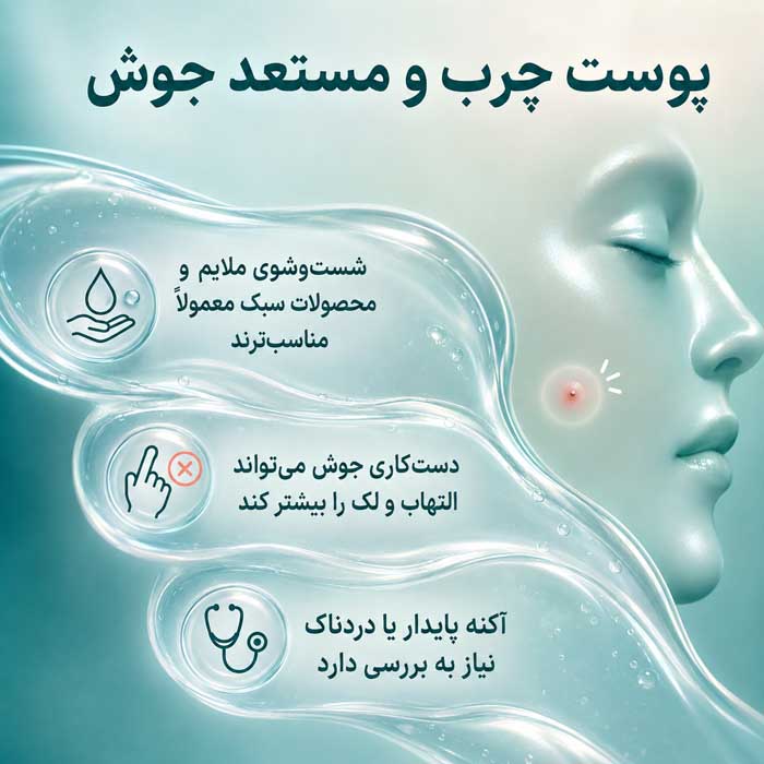 پوست چرب و مستعد جوش