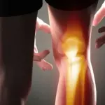 تمام دلایل درد پشت زانو (شایع ترین دلایل ایجاد کننده درد) تمام دلایل درد پشت زانو (شایع ترین دلایل ایجاد کننده درد)
