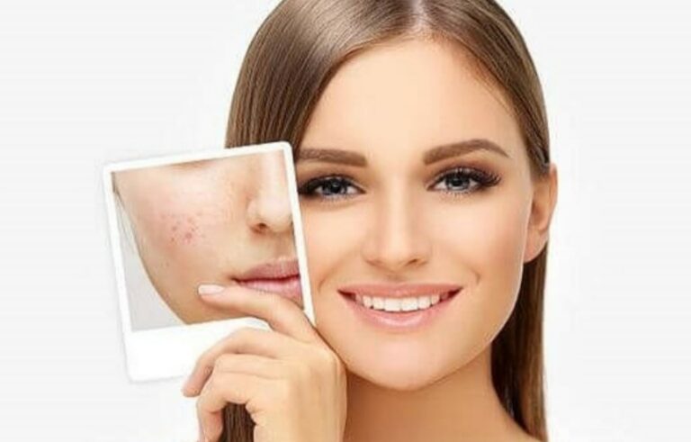 دستگاه هیدروفیشیال برای اکسیژن رسانی و زیبایی پوست