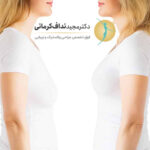 تفاوت لیفت سینه و پروتز سینه تفاوت لیفت سینه و پروتز سینه