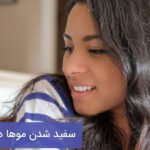 سفید شدن مو در جوانی