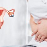 همه چیز درباره تنبلی تخمدان؛ علائم، پیشگیری و روش های درمان