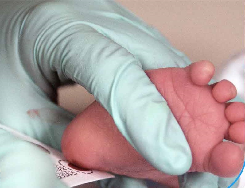 آزمایش تیروئید