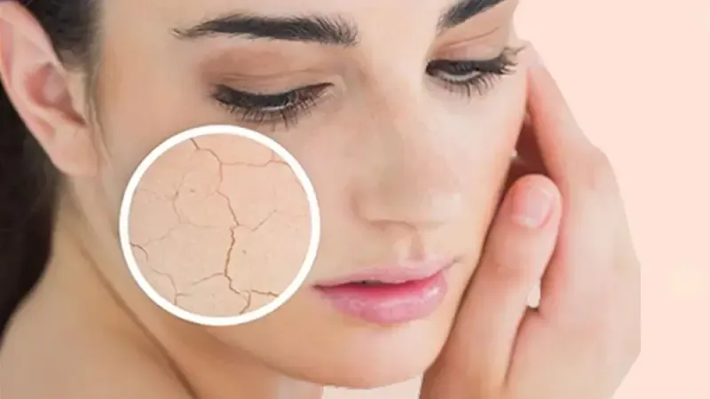 روتین پوست خشک؛ مراقبت از پوست خشک در روز و شب و مراحل روتین آن