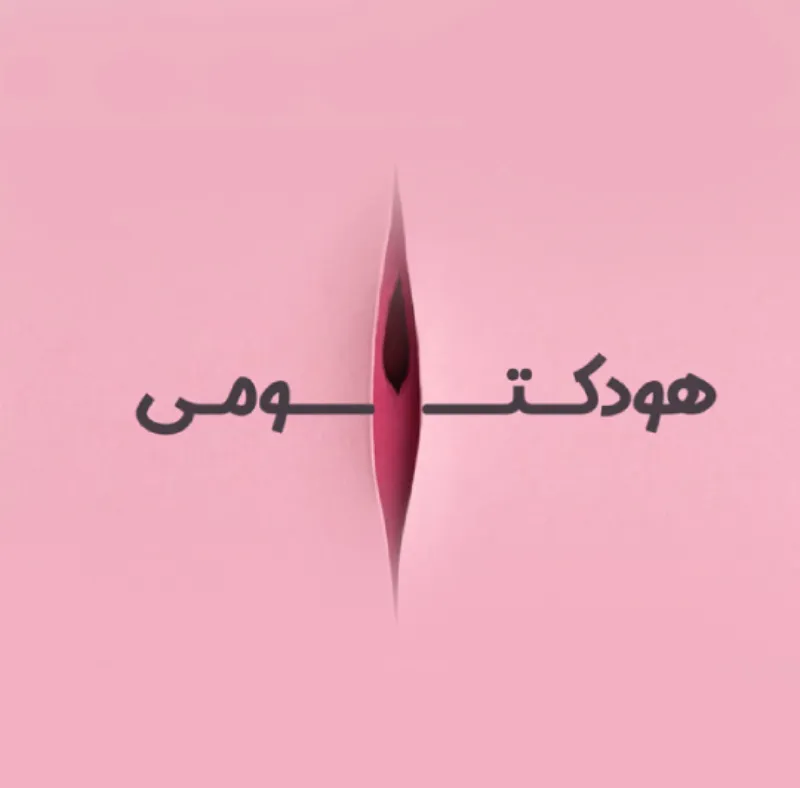 لابیاپلاستی و هودکتومی همزمان لابیاپلاستی و هودکتومی همزمان