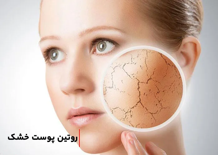 روتین پوست خشک؛ مراقبت از پوست خشک در روز و شب و مراحل روتین آن