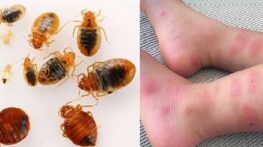 سم ساس کش قوی | درمان ساس | ریشه کنی قطعی و فوری ساس