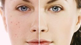 راهکارهای طبیعی برای داشتن پوست زیبا