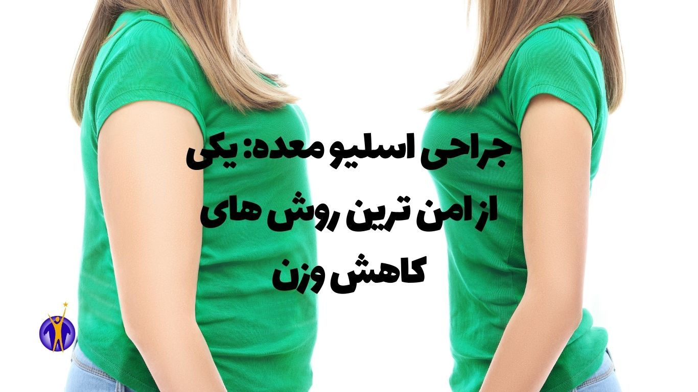 جراحی اسلیو معده یکی از امن ترین روشهای کاهش وزن