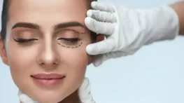 بلفاروپلاستی