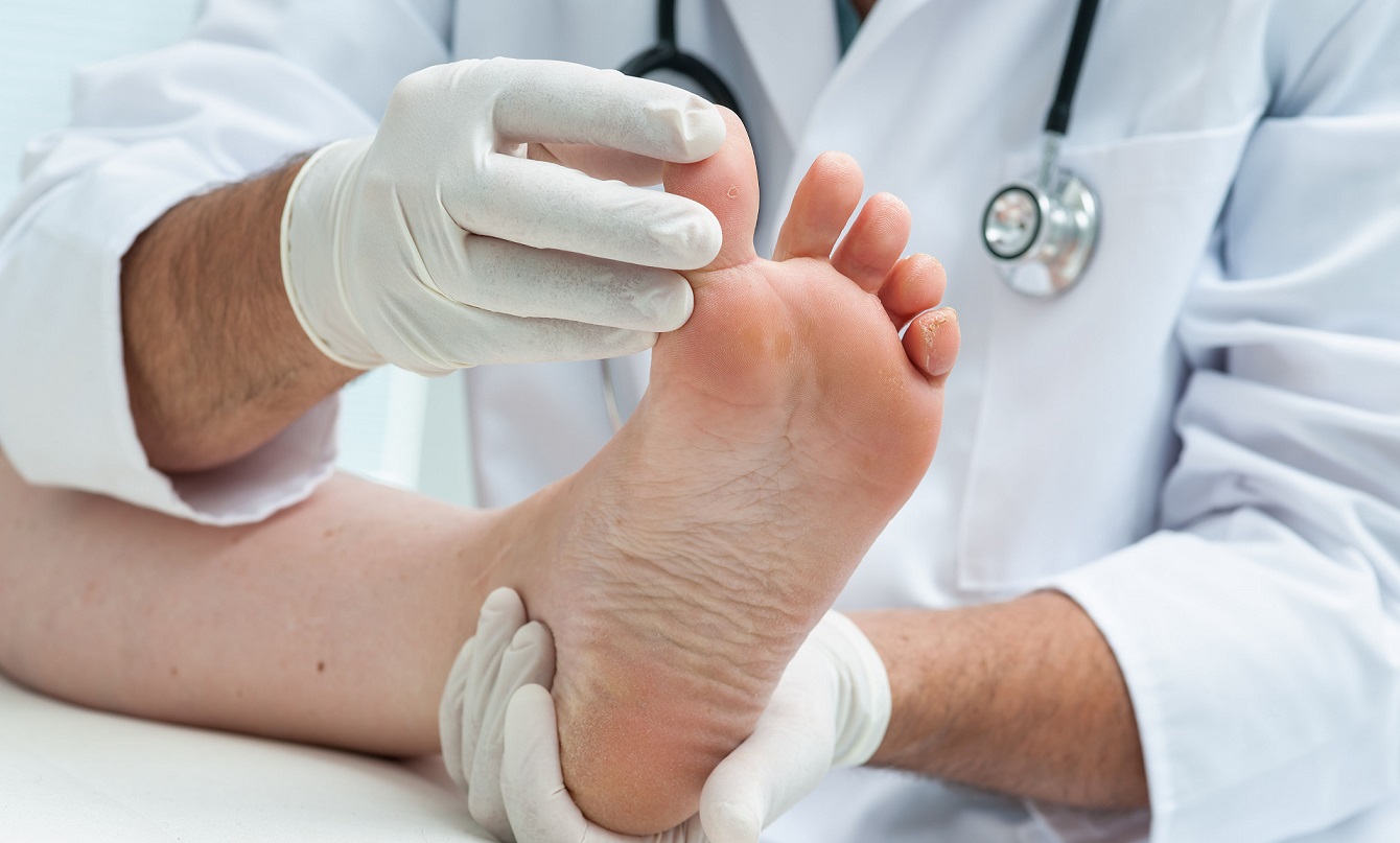 درمان ورم پا با زردچوبه و تخم مرغ + کاهش سریع و موثر