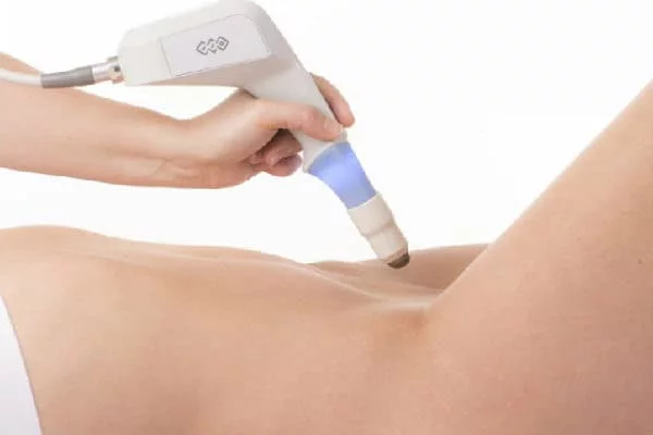 اوزون تراپی واژن چیست و چگونه انجام می شود؟ مزایا و معایب این روش