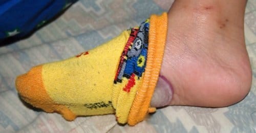 پایین آوردن تب کودک با پیاز | روشی فوری با قطع تب کودکان پایین آوردن تب کودک با پیاز | روشی فوری با قطع تب کودکان