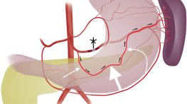 بستن رگ اشتها