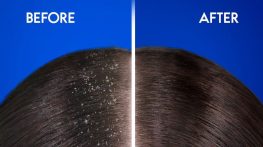 چرا بعد از درمان شوره، به یک شامپوی نگهدارنده نیاز داریم؟ چرا بعد از درمان شوره، به یک شامپوی نگهدارنده نیاز داریم؟