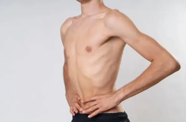 لاغری ناگهانی نشانه چیست؟ + 16 علت مهم کاهش وزن سریع لاغری ناگهانی نشانه چیست؟ + 16 علت مهم کاهش وزن سریع