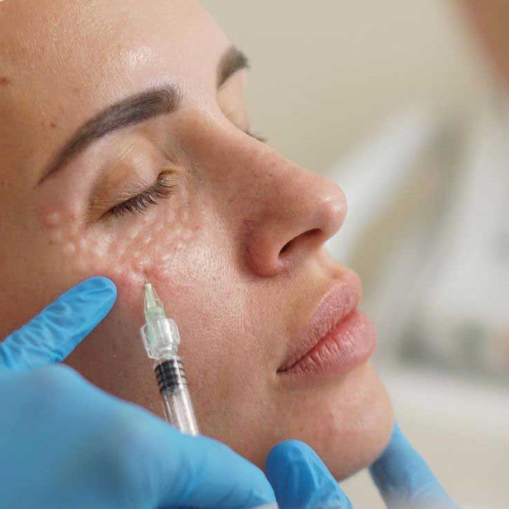 چگونه از عوارض جانبی ژل و فیلر جلوگیری کنیم؟ عوارض مزوتراپی