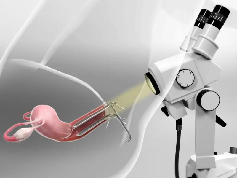 کولپوسکوپی چیست و چگونه انجام می شود؟ و تفاوت با پاپ اسمیر