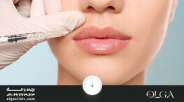 علائم عفونت لب بعد از تزریق ژل و نشانه‌های هشداردهنده