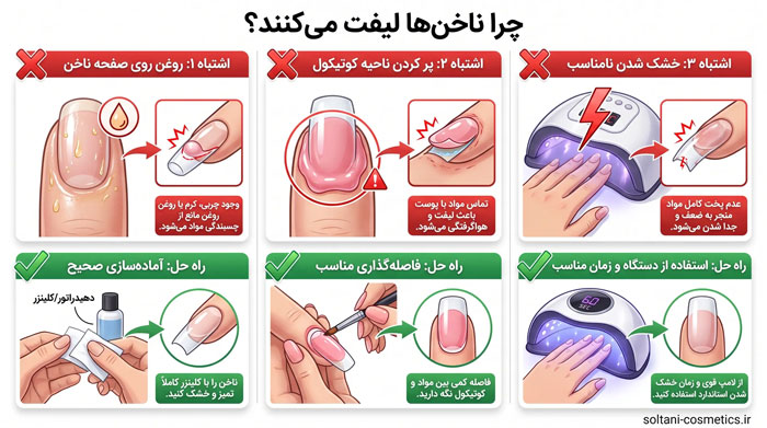 دلایل هواگرفتگی ناخن