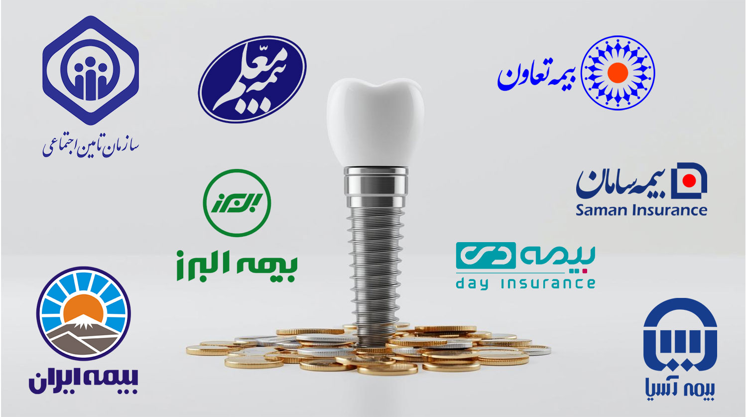 قیمت روکش ایمپلنت در 1405 چقدر است؟ بررسی هزینه انواع روکش قیمت روکش ایمپلنت در 1405 چقدر است؟ بررسی هزینه انواع روکش