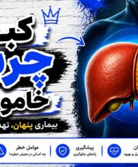 کبد چرب خاموش؛ ۷ علامتی که نادیده میگیرید اما میتوانند خطرناک باشند کبد چرب خاموش