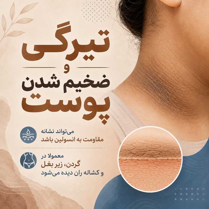 مقاومت به انسولین چیست؟؛ عوامل خطر و نشانههای احتمالی؛ آزمایشهای تشخیصی و راههای کنترل تیرگی و ضخیم شدن پوست
