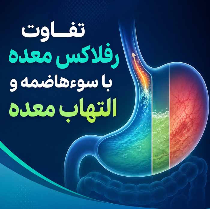 تفاوت رفلاکس معده با سوءهاضمه و التهاب معده