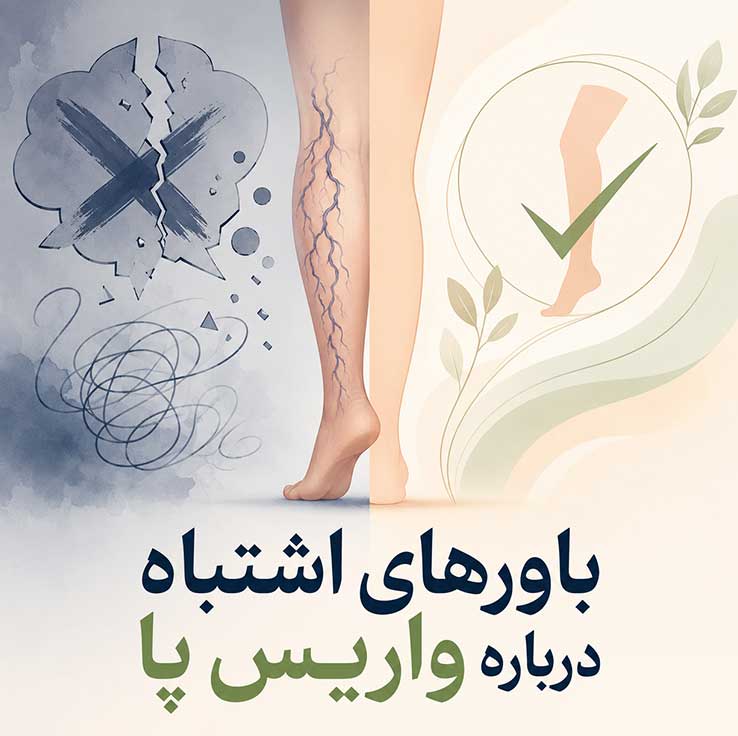 واریس پا چیست؟ بررسی کامل علائم، علتها، روشهای درمان و راههای پیشگیری از واریس پا باورهای اشتباه درباره واریس پا