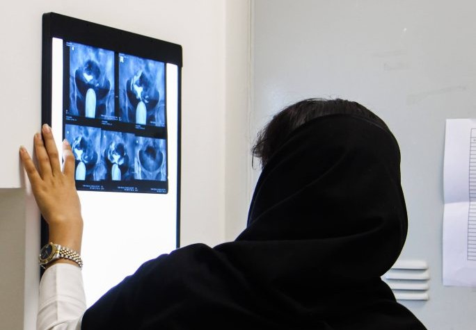 تشخیص دقیق بیماریهای پستان و بررسیهای تخصصی | رادیولوژی تابا تشخیص دقیق بیماریهای پستان و بررسیهای تخصصی | رادیولوژی تابا