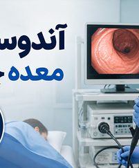 آندوسکوپی معده چیست