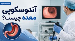 آندوسکوپی معده چیست