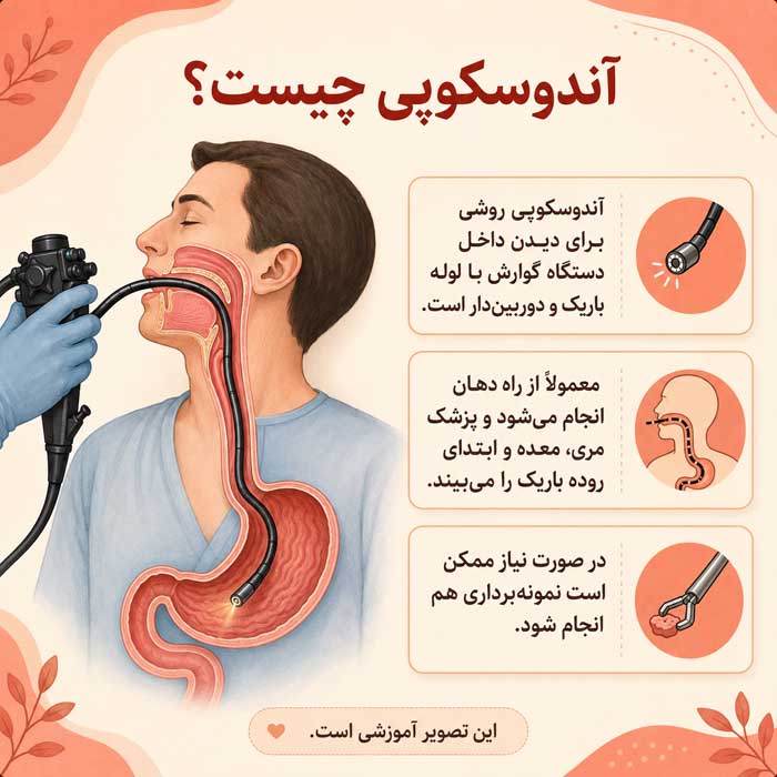 آندوسکوپی معده چیست؟؛ مراحل انجام گاستروسکوپی؛ آمادگی قبل و مراقبتهای بعد آندوسکوپی چیست؟