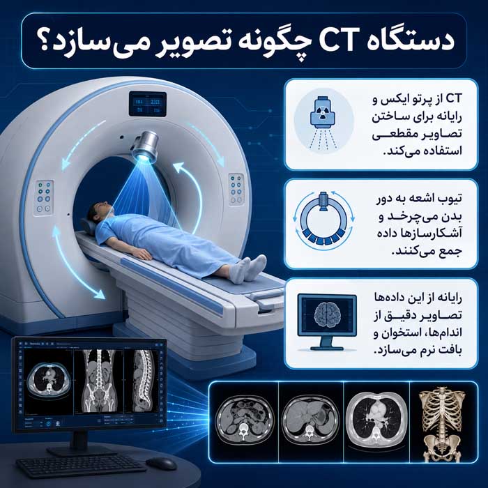 سی تی اسکن چیست؟؛ تفاوت CT با MRI و رادیوگرافی؛ کاربرد هر روش در تصویربرداری پزشکی دستگاه CT چگونه تصویر میسازد؟