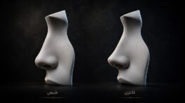 راهنمای انتخاب بین عمل بینی طبیعی و فانتزی؛ کدام برای من مناسبتر است؟ راهنمای انتخاب بین عمل بینی طبیعی و فانتزی؛ کدام برای من مناسبتر است؟