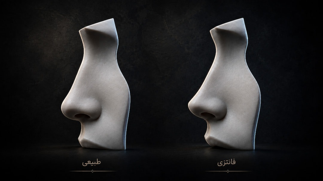 راهنمای انتخاب بین عمل بینی طبیعی و فانتزی؛ کدام برای من مناسبتر است؟ مقایسه فرم بینی طبیعی و فانتزی