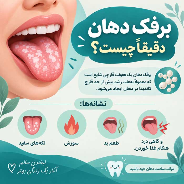 برفک دهان چیست؟؛ علائم و علتهای عفونت کاندیدا؛ درمان و راههای کاهش عود برفک دهان دقیقاً چیست؟
